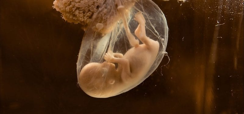 Fetal development stage inside an amniotic sac, showcasing early human embryonic features and growth.