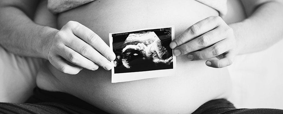 Pregnant person holding an ultrasound photo of a developing fetus against their belly, showcasing a moment of anticipation and joy in pregnancy.